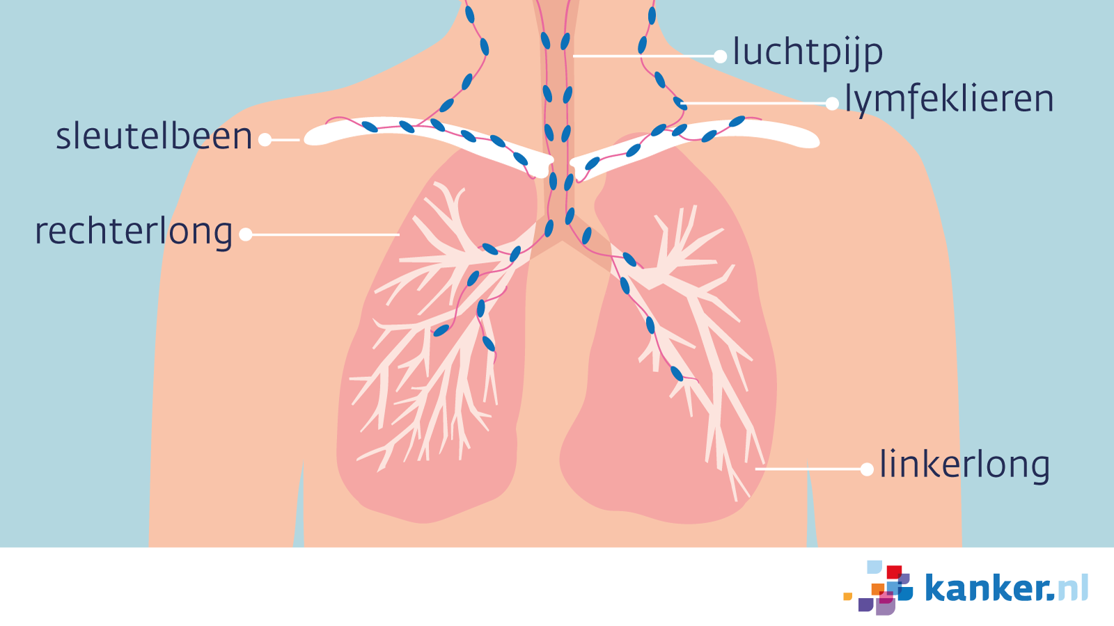 Uitzaaiingen bij longkanker | kanker.nl